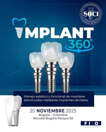 implant360-0